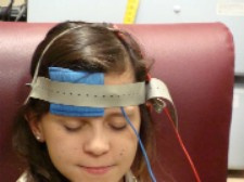 Апарат за ТЕС tDCS стимулация на мозъка