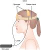 OASIS  PRO - комбиниран апарат за електросън (CES), транс-краниална стимулация (tDCS) с прав постоянен ток, неинвазивна вагусова стимулация (tVNS) и микро-токова електротерапия (МЕТ)